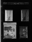Mayor at Federal Works Agency; Automobile wreck; Family (4 Negatives) (October 2, 1957) [Sleeve 2, Folder a, Box 13]